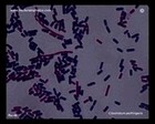 clostridium perfringens under microscope